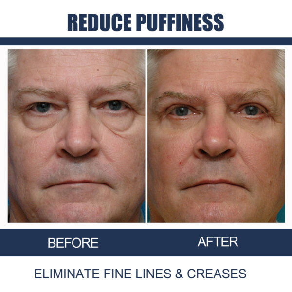 Men's Anti-aging Eye Cream - Image 6