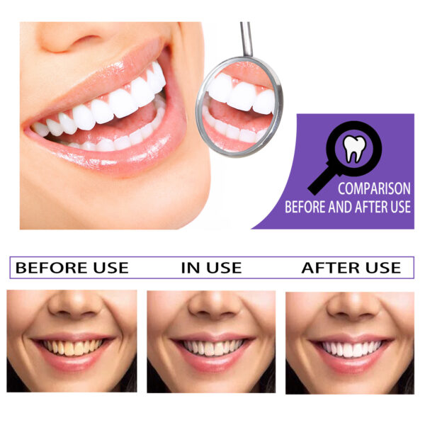 Teeth Whitening Toothpaste Whitening Teeth Removal - Image 2