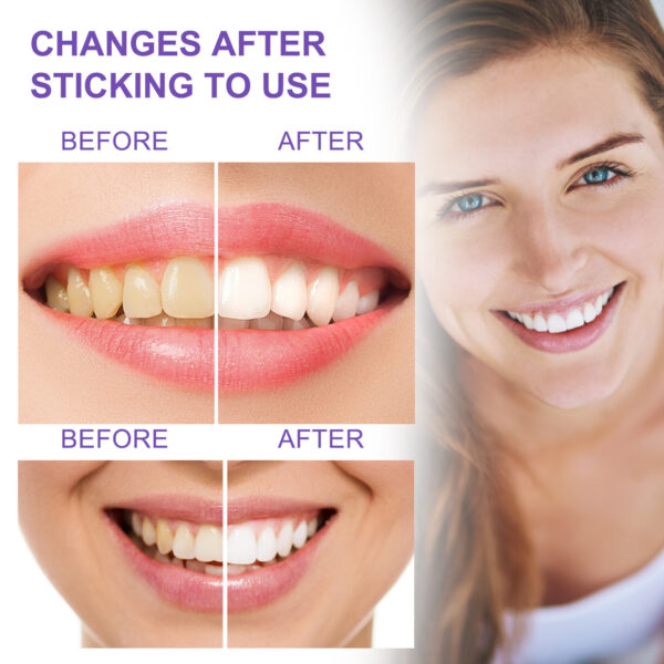 Teeth Whitening Toothpaste Whitening Teeth Removal - Image 3