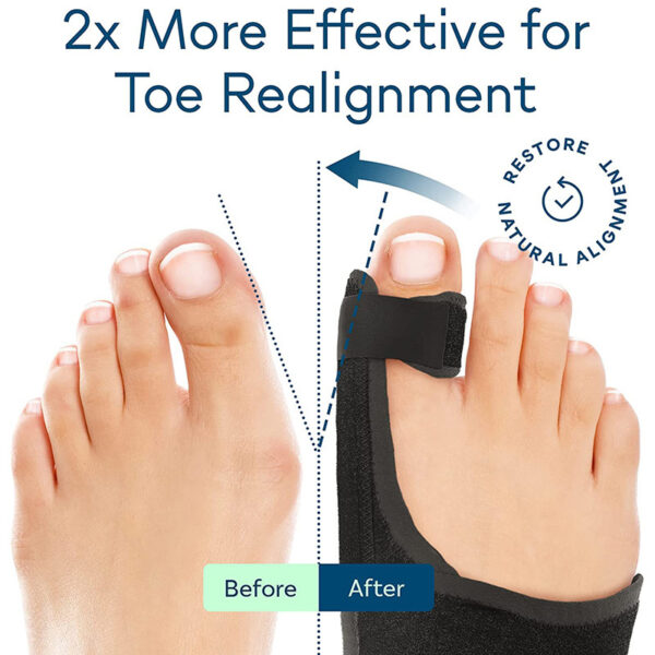 Big Toe Brace Hallux Valgus Orthotics Band - Image 4