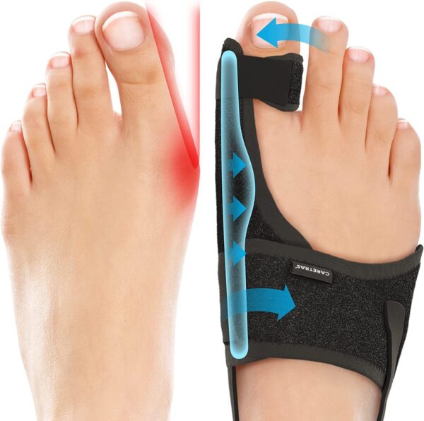 Big Toe Brace Hallux Valgus Orthotics Band