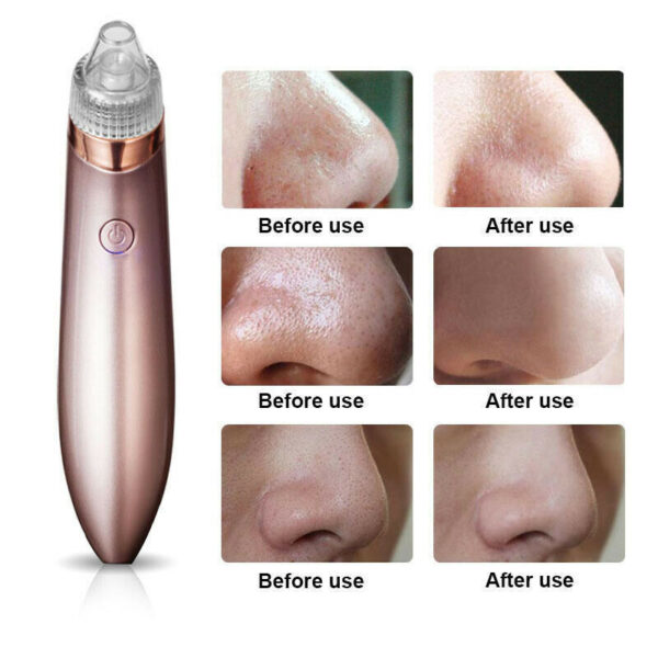 Electric Blackhead Vacuum Pore Cleaner Acne Pimple Remover Strong Suction Tool Electric Blackhead Remover Pore Vacuum Suction Diamond Dermabrasion Face Cleaner - Image 4